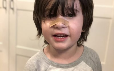 Day 129: Band-Aid Bonanza